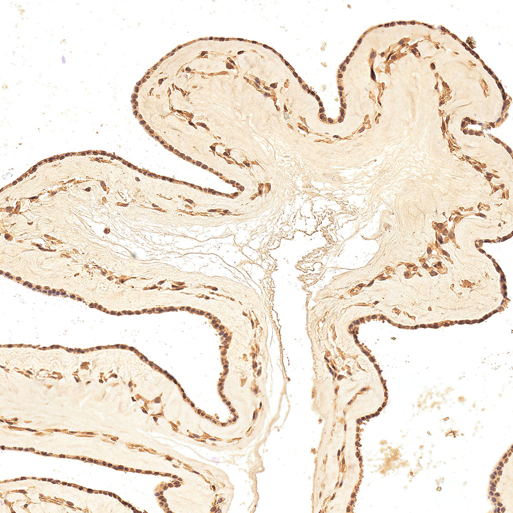 sars-cov-2 gene expression in a human fetus